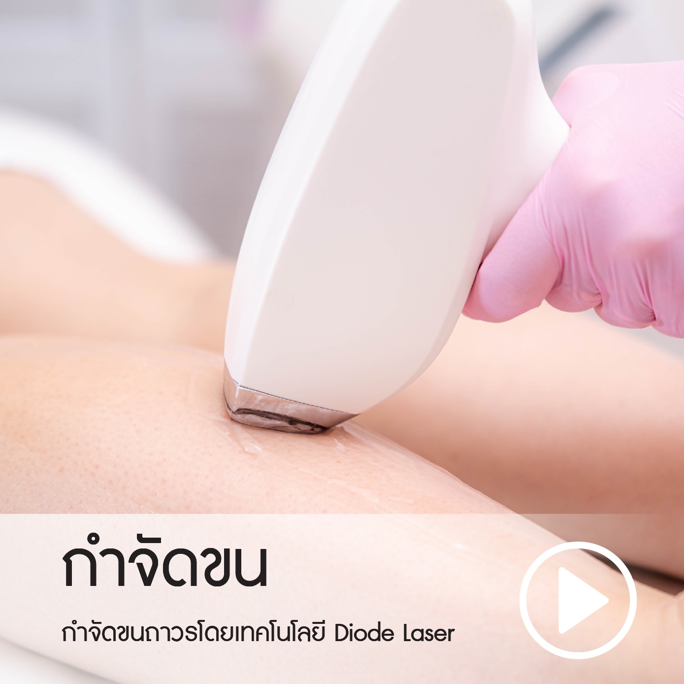 กำจัดขน