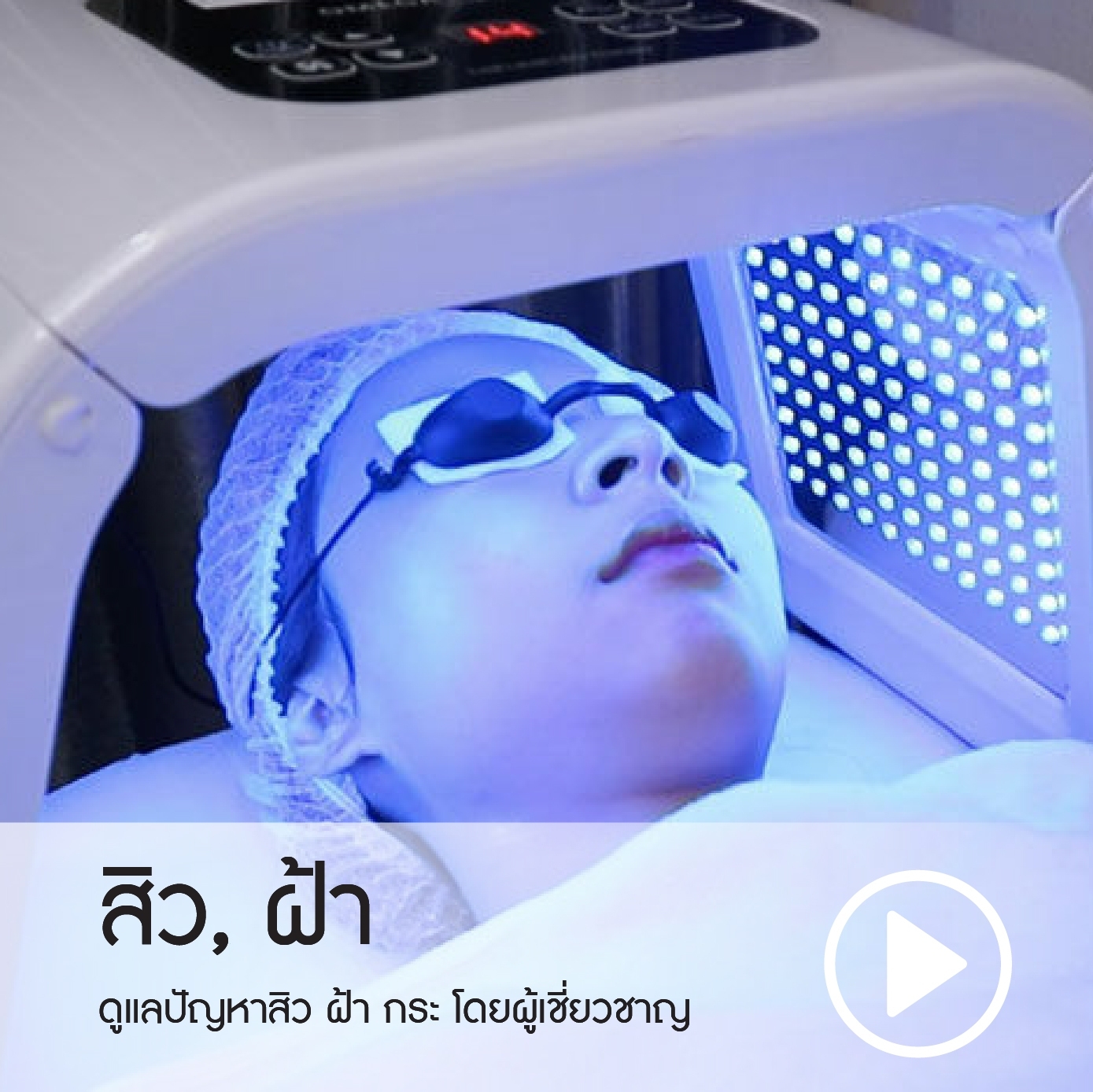 โปรโมชั่น สิว ฝ้า